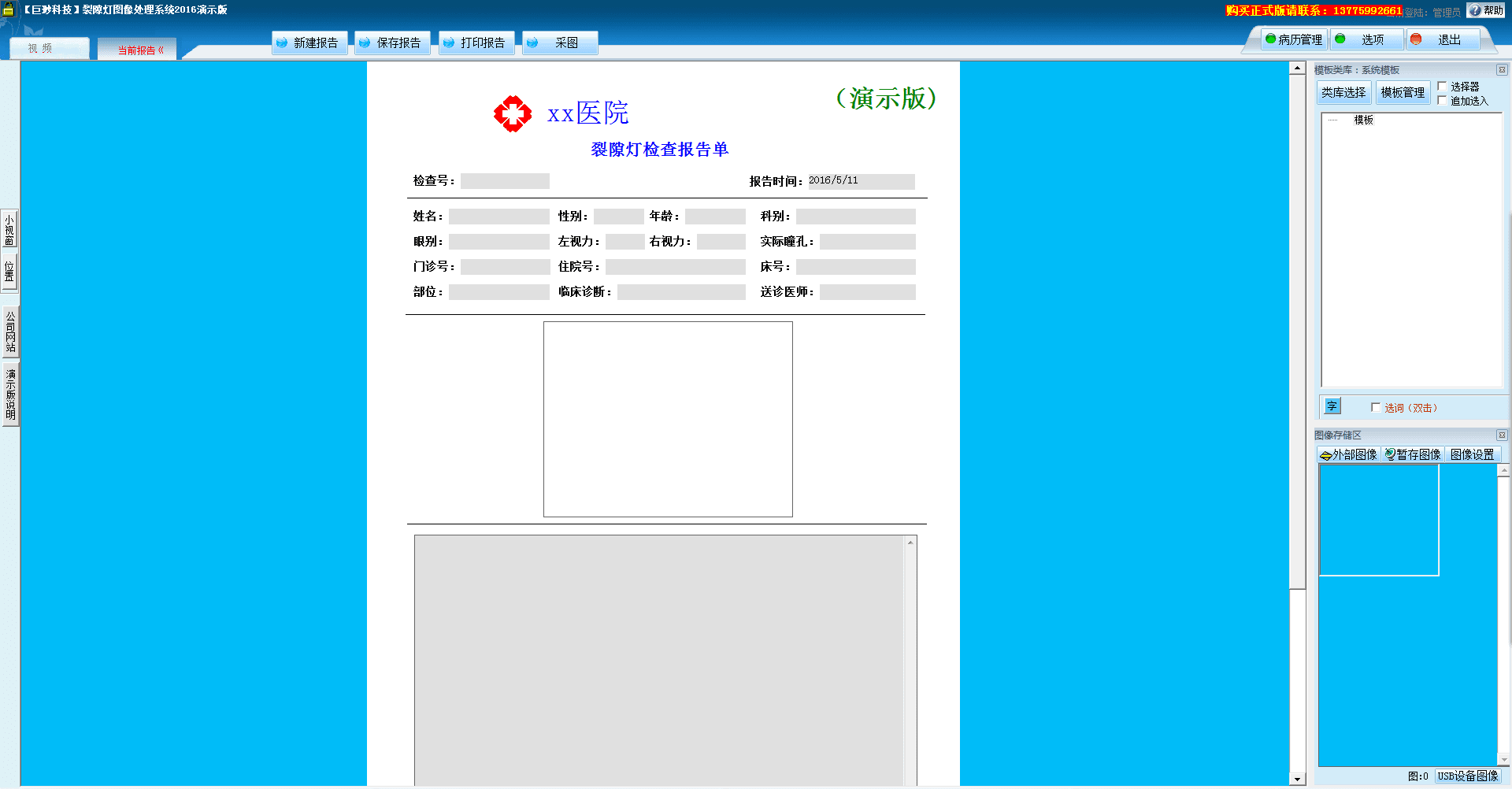 裂隙灯图像处理系统 官方版